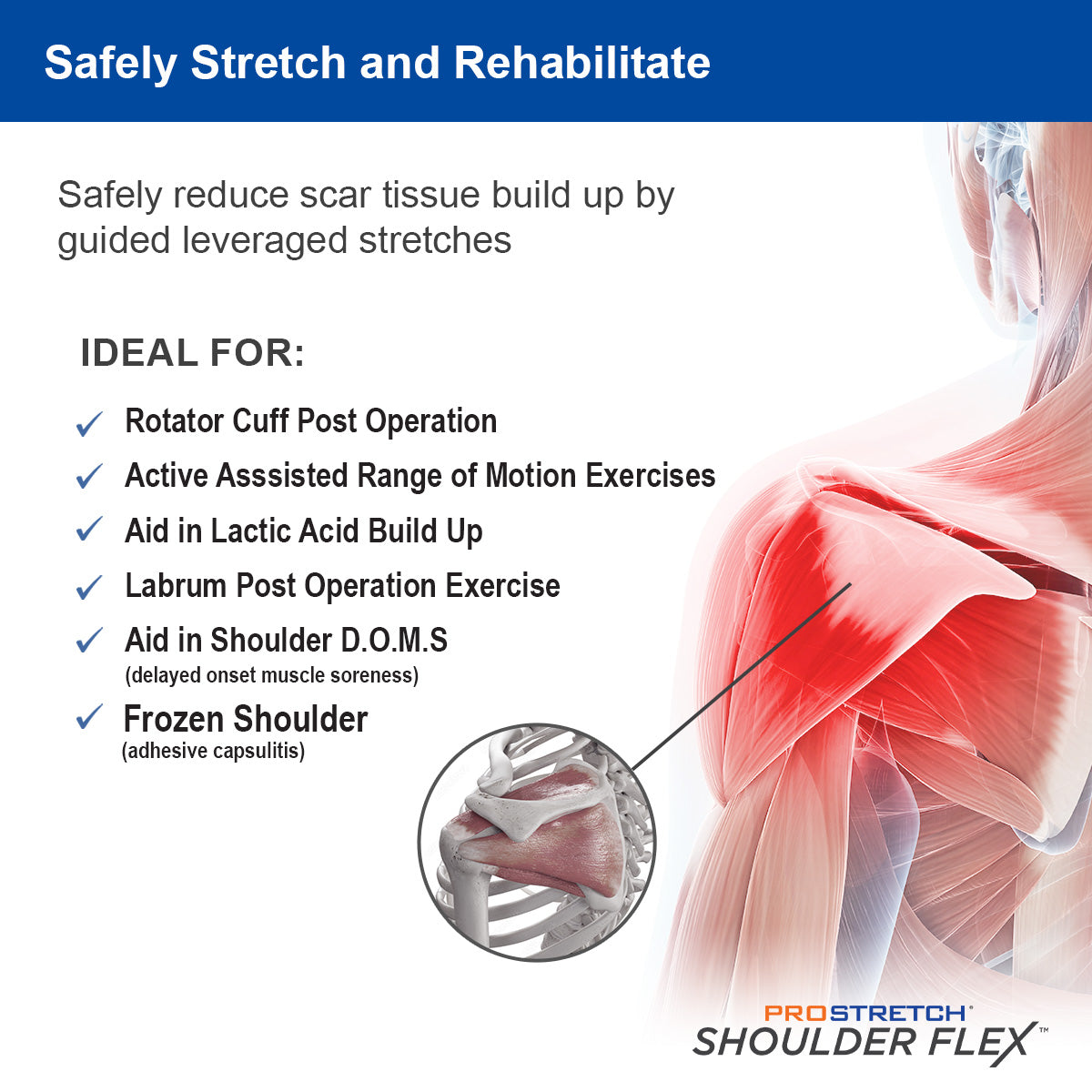 how to safely reduce scar tissue build up using guided leveraged stretches using ProStretch ShoulderFlex